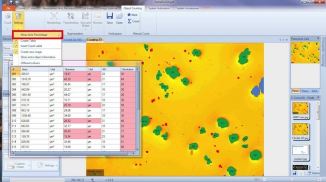 Module de comptage du logiciel de microscopie DELTAPIX