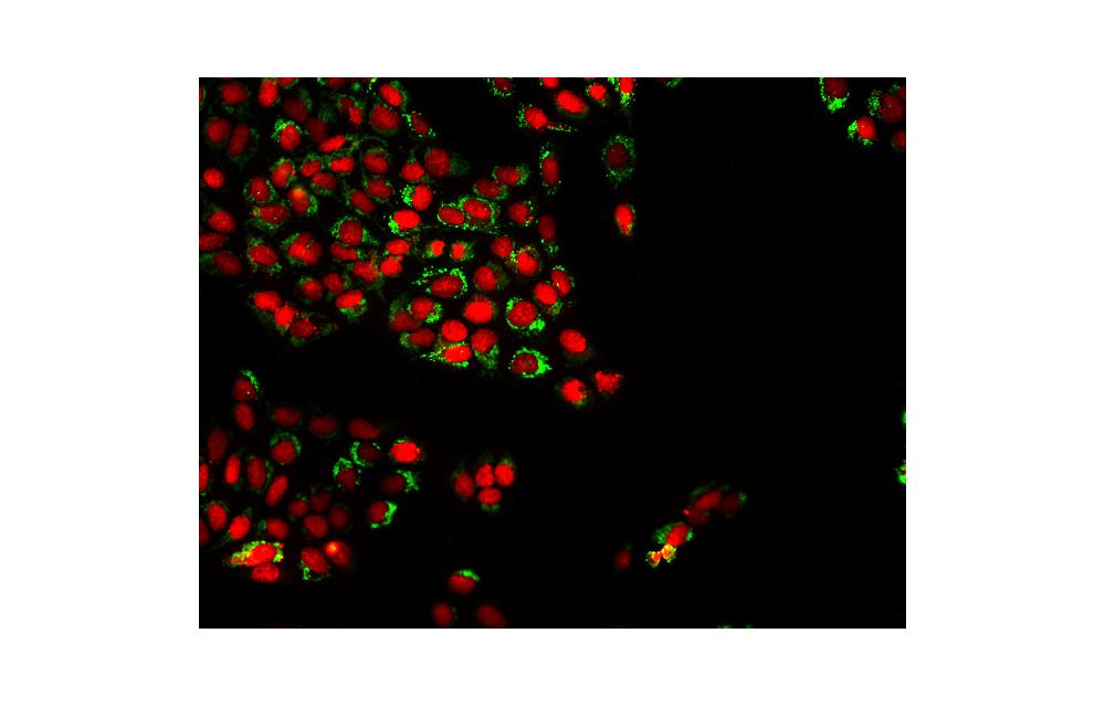 Imagerie en fluorescence