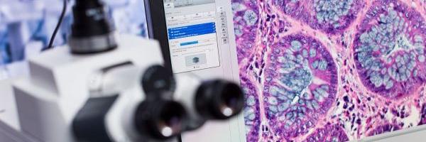 Comment Fonctionne la Cam�ra d�un Microscope Num�rique ?