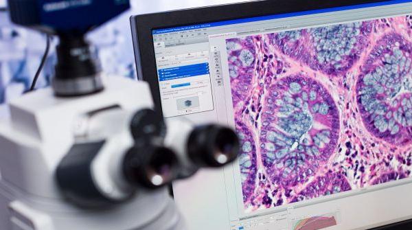 Comment Fonctionne la Cam&eacute;ra d�un Microscope Num&eacute;rique ?