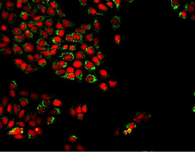 Imagerie en fluorescence