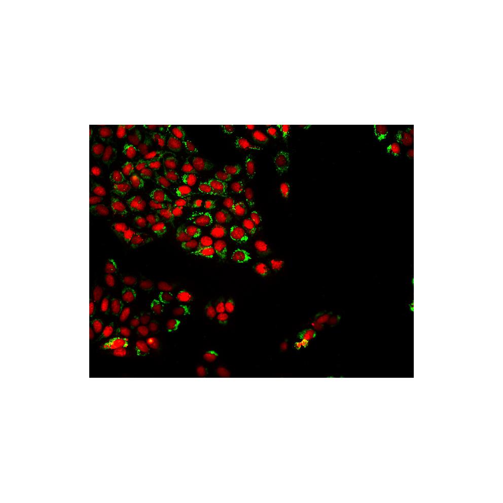 Imagerie en fluorescence